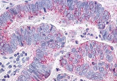 CCR10 Antibody in Immunohistochemistry (Paraffin) (IHC (P))