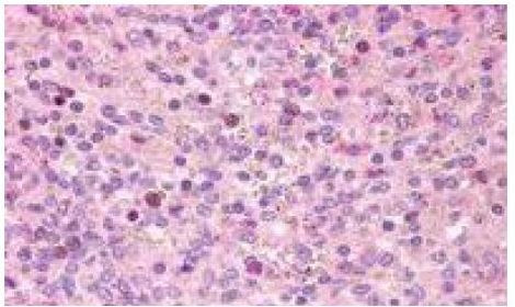 GPR171 Antibody in Immunohistochemistry (Paraffin) (IHC (P))