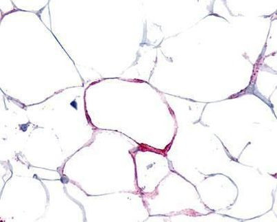VIPR1 Antibody in Immunohistochemistry (IHC)