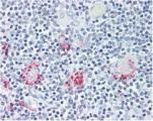 ROR gamma Antibody in Immunohistochemistry (Paraffin) (IHC (P))