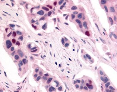 CDK12 Antibody in Immunohistochemistry (Paraffin) (IHC (P))