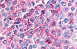 MINK1 Antibody in Immunohistochemistry (Paraffin) (IHC (P))