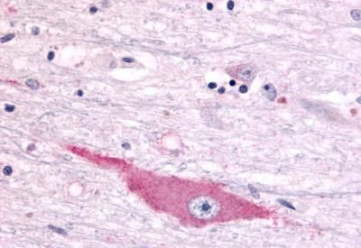 DUSP22 Antibody in Immunohistochemistry (Paraffin) (IHC (P))