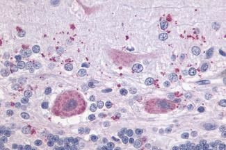 LPAR4 Antibody in Immunohistochemistry (Paraffin) (IHC (P))