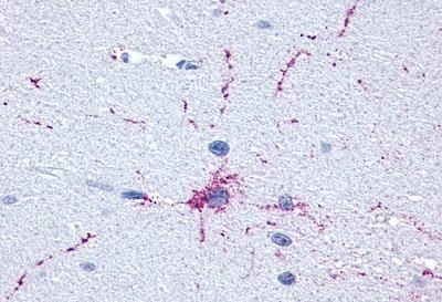 mGluR8 Antibody in Immunohistochemistry (Paraffin) (IHC (P))