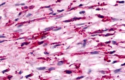 GPR160 Antibody in Immunohistochemistry (Paraffin) (IHC (P))