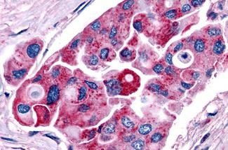 TSH Receptor Antibody in Immunohistochemistry (Paraffin) (IHC (P))