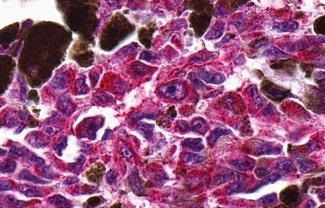 NTSR2 Antibody in Immunohistochemistry (Paraffin) (IHC (P))