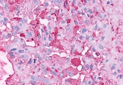 GPR37 Antibody in Immunohistochemistry (Paraffin) (IHC (P))