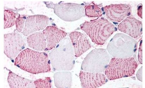 GPRC6A Antibody in Immunohistochemistry (Paraffin) (IHC (P))