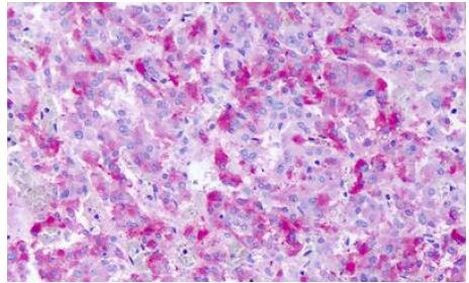 GPCR LS190419 Antibody in Immunohistochemistry (Paraffin) (IHC (P))