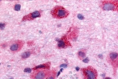 EDG8 Antibody in Immunohistochemistry (Paraffin) (IHC (P))