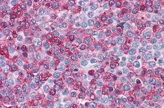 FZD1 Antibody in Immunohistochemistry (Paraffin) (IHC (P))