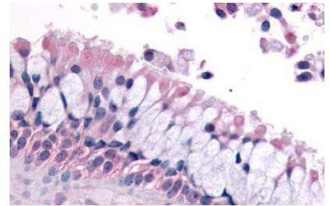 LS189744 Antibody in Immunohistochemistry (Paraffin) (IHC (P))