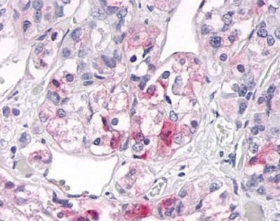 OR2H2 Antibody in Immunohistochemistry (IHC)