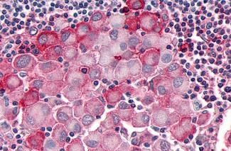 OR10R2 Antibody in Immunohistochemistry (Paraffin) (IHC (P))