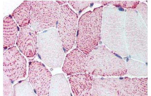 RXFP2 Antibody in Immunohistochemistry (Paraffin) (IHC (P))