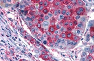 GPR108 Antibody in Immunohistochemistry (Paraffin) (IHC (P))