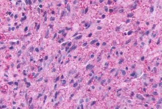 GPR137B Antibody in Immunohistochemistry (Paraffin) (IHC (P))