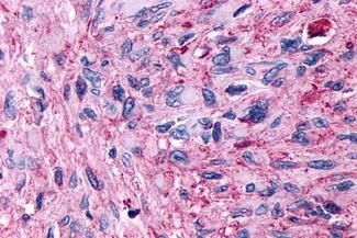 GPR89B Antibody in Immunohistochemistry (Paraffin) (IHC (P))