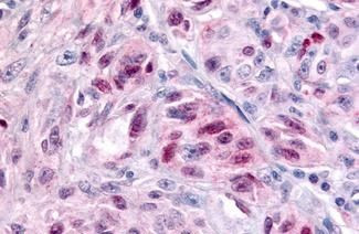 NR1D2 Antibody in Immunohistochemistry (Paraffin) (IHC (P))