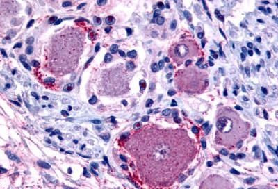 MRGPRX4 Antibody in Immunohistochemistry (Paraffin) (IHC (P))