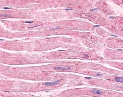 alpha-2c Adrenergic Receptor Antibody in Immunohistochemistry (IHC)