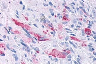 MRGD Antibody in Immunohistochemistry (Paraffin) (IHC (P))