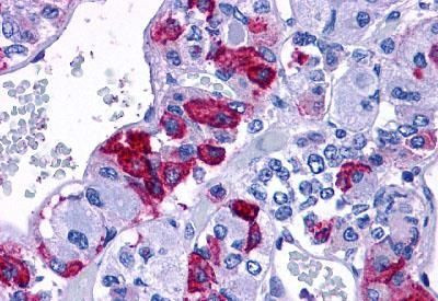 PACAP Receptor Antibody in Immunohistochemistry (Paraffin) (IHC (P))