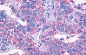 EDG3 Antibody in Immunohistochemistry (Paraffin) (IHC (P))