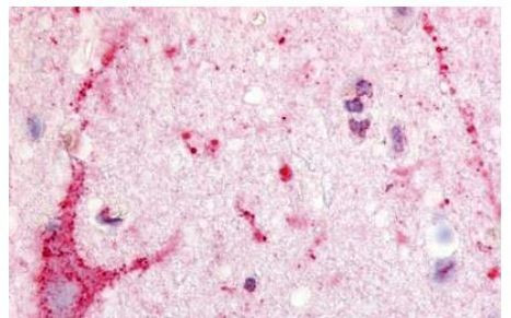 EDG8 Antibody in Immunohistochemistry (Paraffin) (IHC (P))