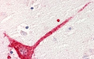 GPR182 Antibody in Immunohistochemistry (Paraffin) (IHC (P))