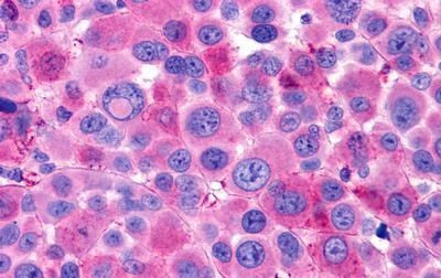 LGR6 Antibody in Immunohistochemistry (Paraffin) (IHC (P))