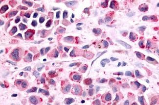 Prostaglandin E Receptor EP1 Antibody in Immunohistochemistry (Paraffin) (IHC (P))