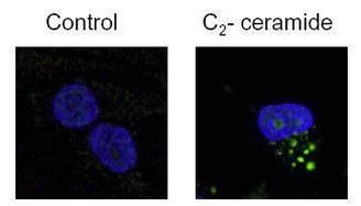 LC3B Antibody in Immunocytochemistry (ICC/IF)