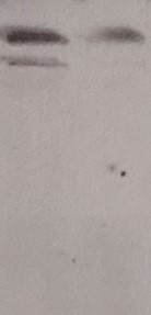 FXR Antibody in Western Blot (WB)