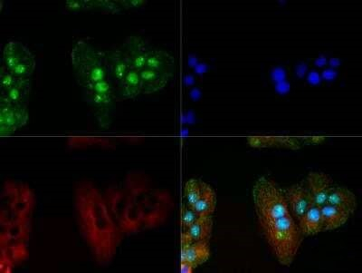 MECP2 Antibody in Immunocytochemistry (ICC/IF)