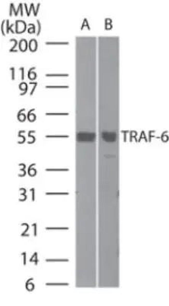 TRAF6 Antibody in Western Blot (WB)