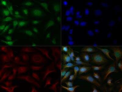 NOXA Antibody in Immunocytochemistry (ICC/IF)