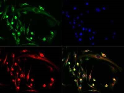 NFATC1 Antibody in Immunocytochemistry (ICC/IF)