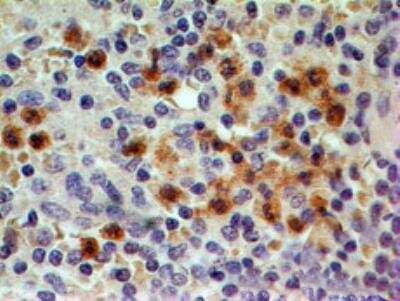 CCR1 Antibody in Immunohistochemistry (Paraffin) (IHC (P))