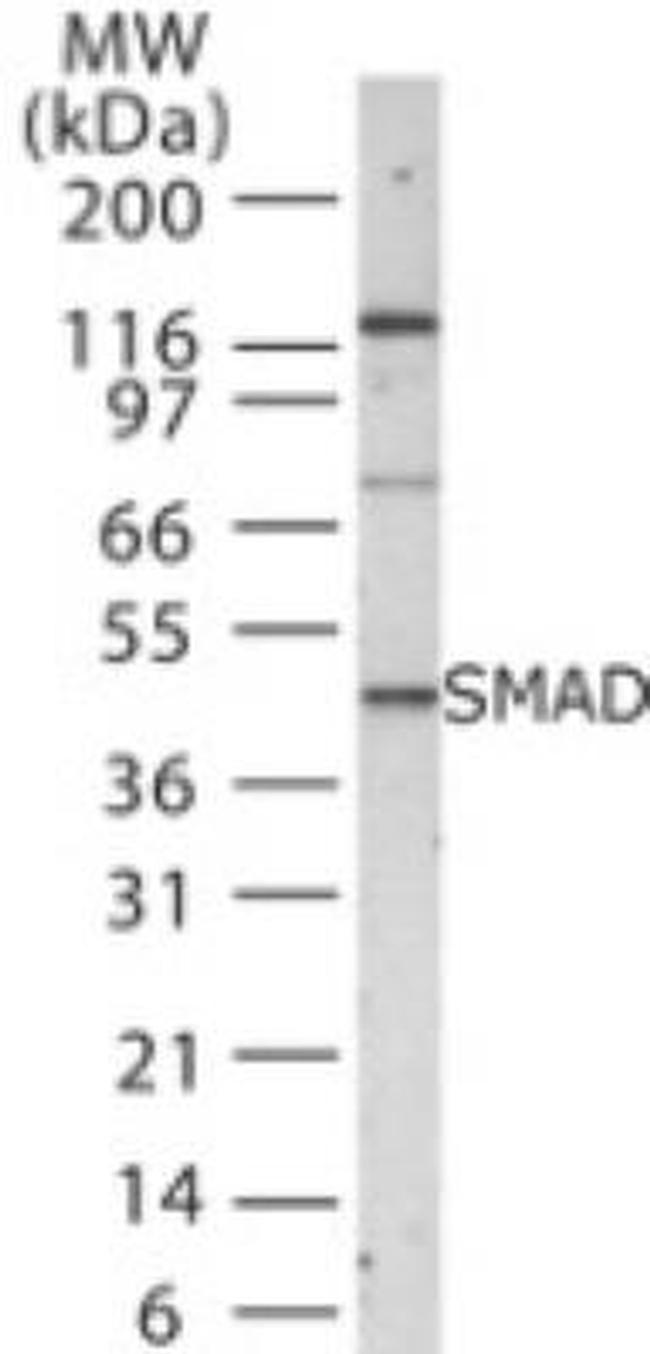 SMAD1/SMAD5/SMAD9 Antibody in Western Blot (WB)