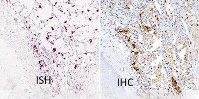 SARS Coronavirus Nucleocapsid Antibody in Immunohistochemistry (Paraffin) (IHC (P))
