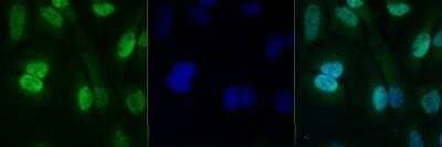 PRMT4 Antibody in Immunocytochemistry (ICC/IF)