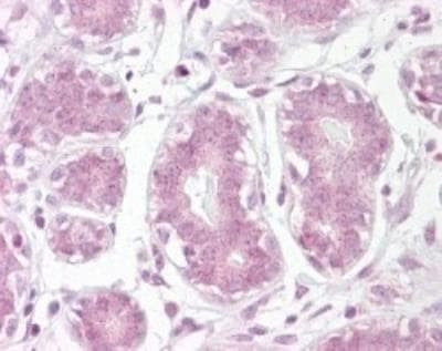 IkB alpha Antibody in Immunohistochemistry (Paraffin) (IHC (P))