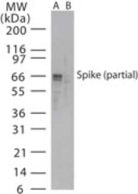 SARS Coronavirus Spike Protein Antibody in Western Blot (WB)