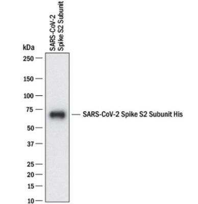 SARS Coronavirus Spike Protein Antibody in Western Blot (WB)