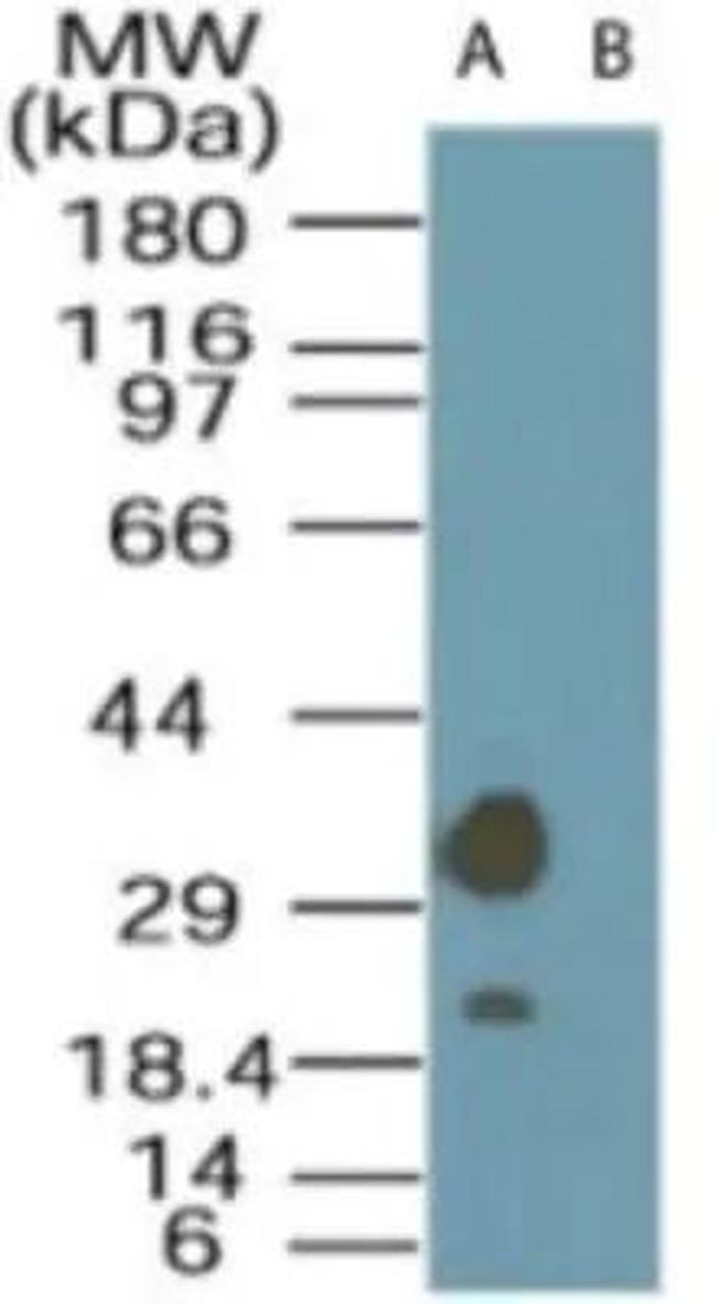 LYK5 Antibody in Western Blot (WB)
