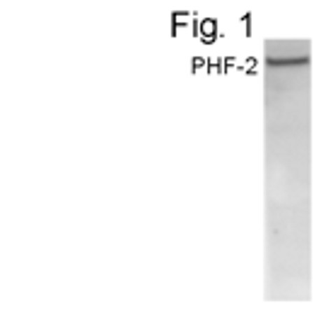 PHF2 Antibody in Western Blot (WB)