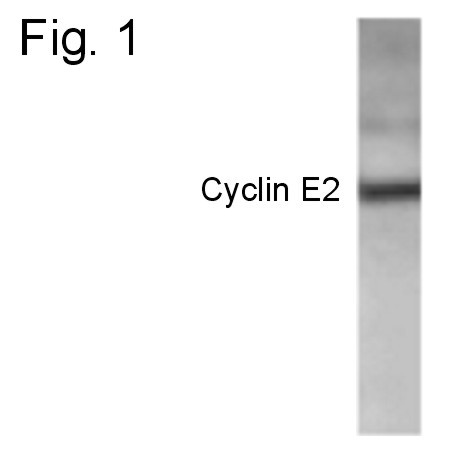 Cyclin E2 Antibody in Western Blot (WB)